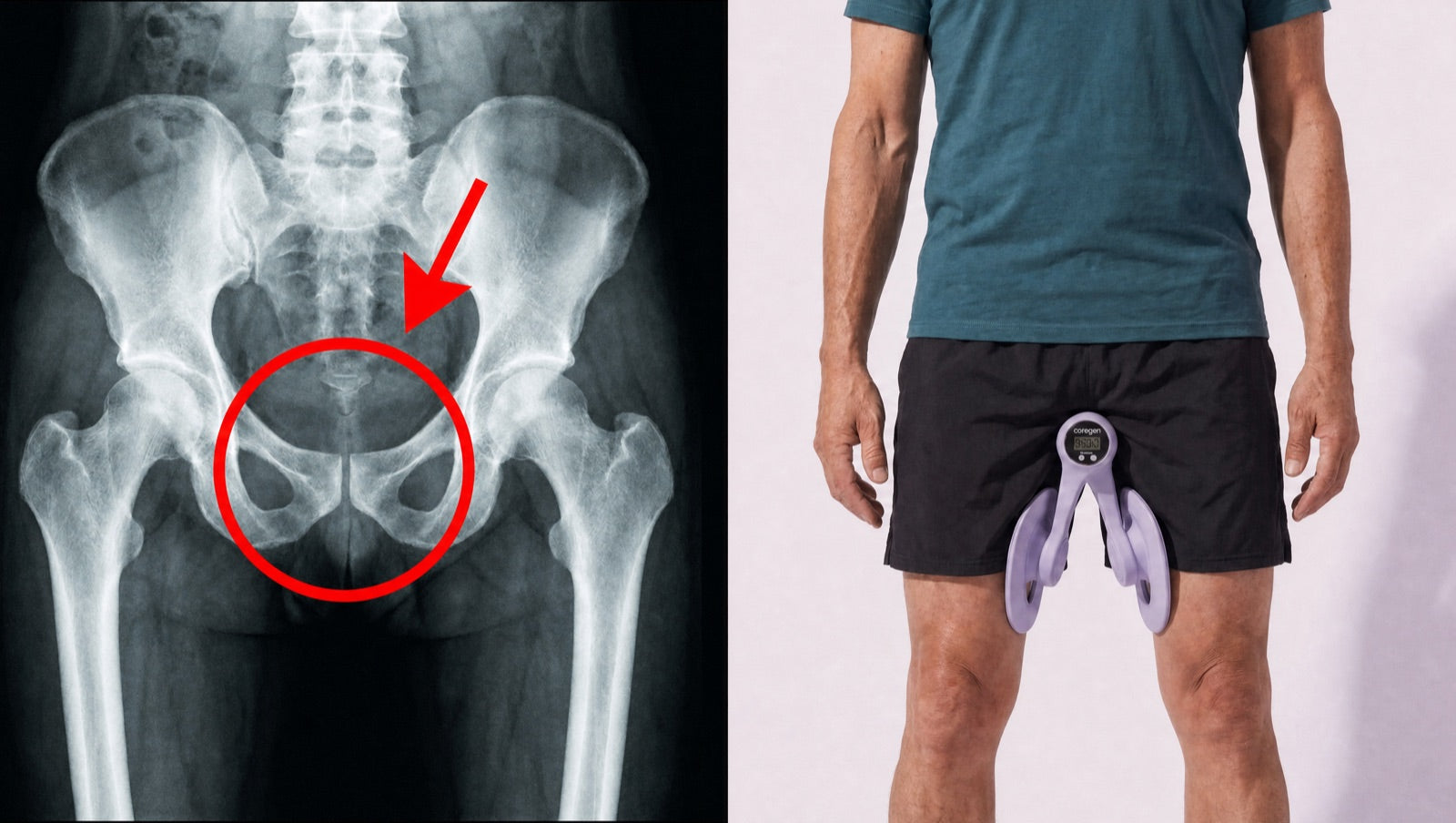 Pelvic X-ray beside a man using the Coreogen pelvic trainer